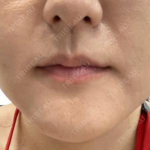 HAAB×DREAM BEAUTY CLINIC 大阪梅田院口コミ