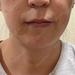 湘南美容クリニック 新橋銀座口院口コミ