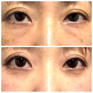 神戸美容外科 ネビュラクリニック口コミ