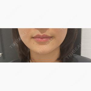 R Beauty CLINIC 名古屋院口コミ