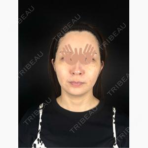 藤・ナチュレ美容クリニック 銀座院口コミ