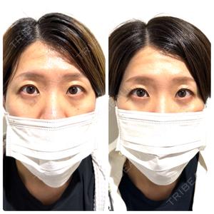 神戸美容外科 ネビュラクリニック口コミ