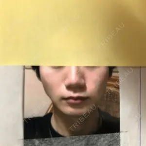 Zetith Beauty Clinic 銀座院口コミ