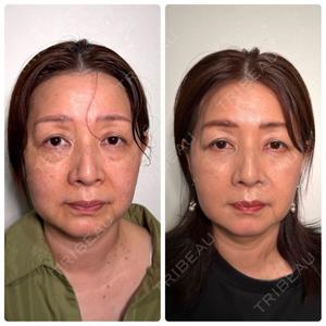神戸美容外科 ネビュラクリニック口コミ