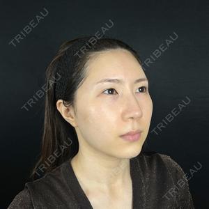 藤・ナチュレ美容クリニック 銀座院口コミ