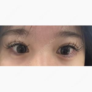 HAAB×DREAM BEAUTY CLINIC 大阪梅田院口コミ