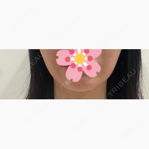ルラ美容クリニック 名古屋栄院 / ルラスキンクリニック 名古屋栄院口コミ