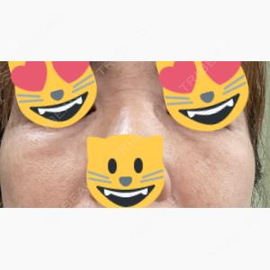 HAAB×DREAM BEAUTY CLINIC 東京本院口コミ