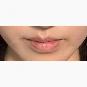 麻布十番クレールデンタルクリニック口コミ
