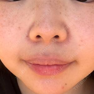 MYU CLINIC口コミ