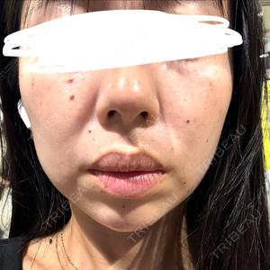 DMTC CLINIC 日本橋院口コミ