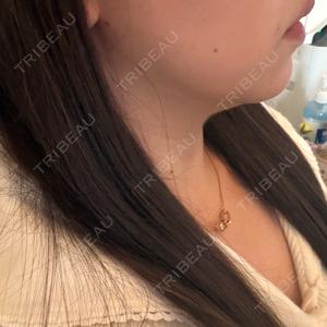 ROHE CLINIC GINZA口コミ