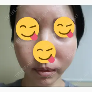 ウィーバー美容外科口コミ