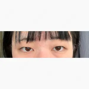 エートップ美容整形外科口コミ