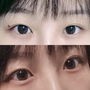 RG整形外科（旧リオン整形外科）口コミ