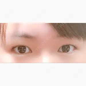 MIYAフェイスクリニック口コミ