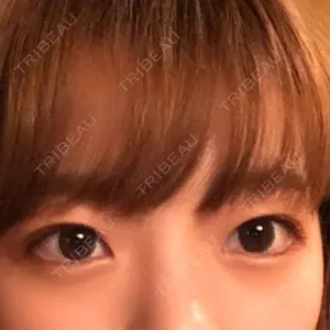 品川美容外科 札幌院口コミ