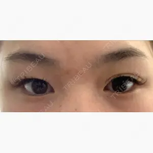 湘南美容クリニック 広島院口コミ