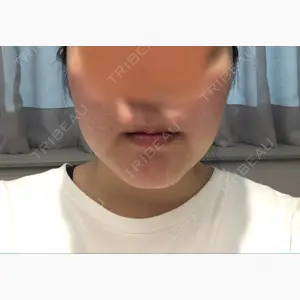 ボンディ美容整形外科（旧リオン整形外科）口コミ