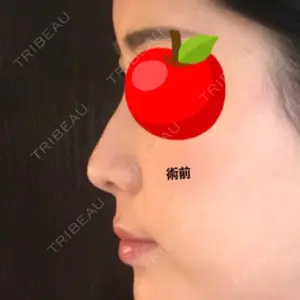 GIRIN（ギリン）美容外科口コミ