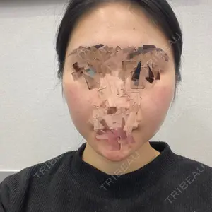 ボンディ美容整形外科（旧リオン整形外科）口コミ