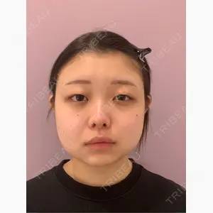 藤・ナチュレ美容クリニック 恵比寿院口コミ