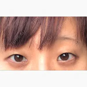 ティーズクリニック口コミ