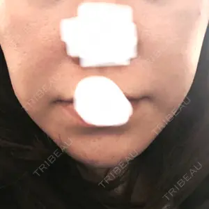 ウィーバー美容外科口コミ