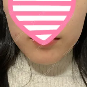 アサミ美容外科 大阪院口コミ