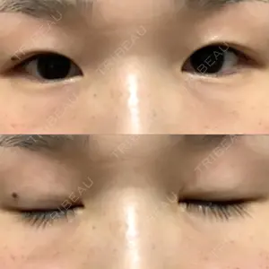 銀座高須クリニック口コミ