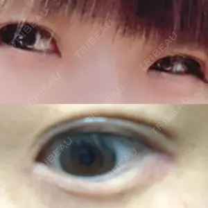 湘南美容クリニック 池袋東口院口コミ