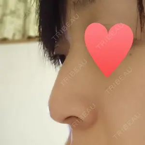 ハニークリニック口コミ