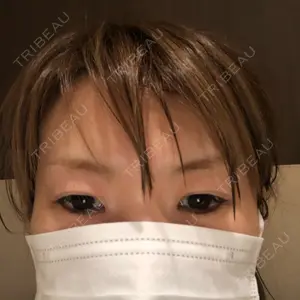 品川美容外科 梅田院口コミ