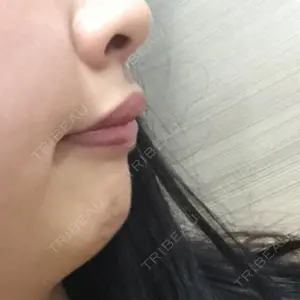 湘南美容クリニック 大宮院口コミ