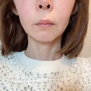 こいずみ形成クリニック名古屋口コミ