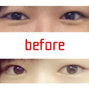 湘南美容クリニック 大宮院口コミ