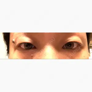 品川美容外科 大宮院口コミ