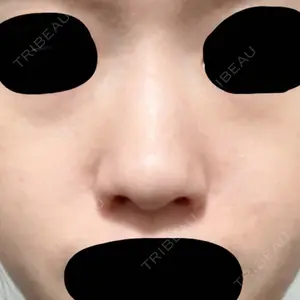リッツ美容外科 東京院口コミ
