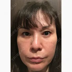 麗ビューティー皮フ科クリニック口コミ