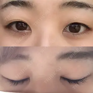 ITEM美容（整形）外科口コミ