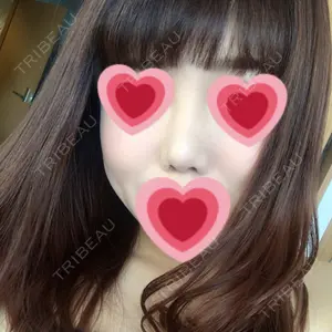 エイペックス美容外科口コミ