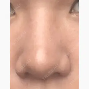 新垣形成外科口コミ