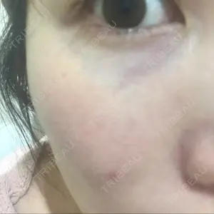 プライム銀座美容クリニック口コミ