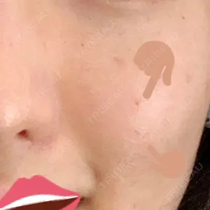 石神井公園駅前皮フ科口コミ