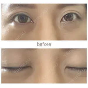 心斎橋コムロ美容外科クリニック口コミ