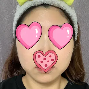 湘南美容クリニック 広島院口コミ