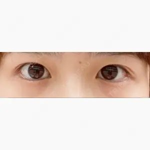 銀座高須クリニック口コミ