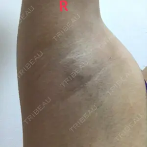 リオラビューティークリニック 上野院口コミ