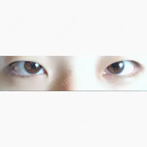 植村美容外科口コミ