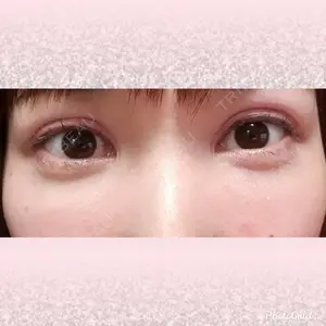 CLASSY 仙台美容外科・美容皮膚科口コミ